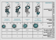 Coccidia species in poultry